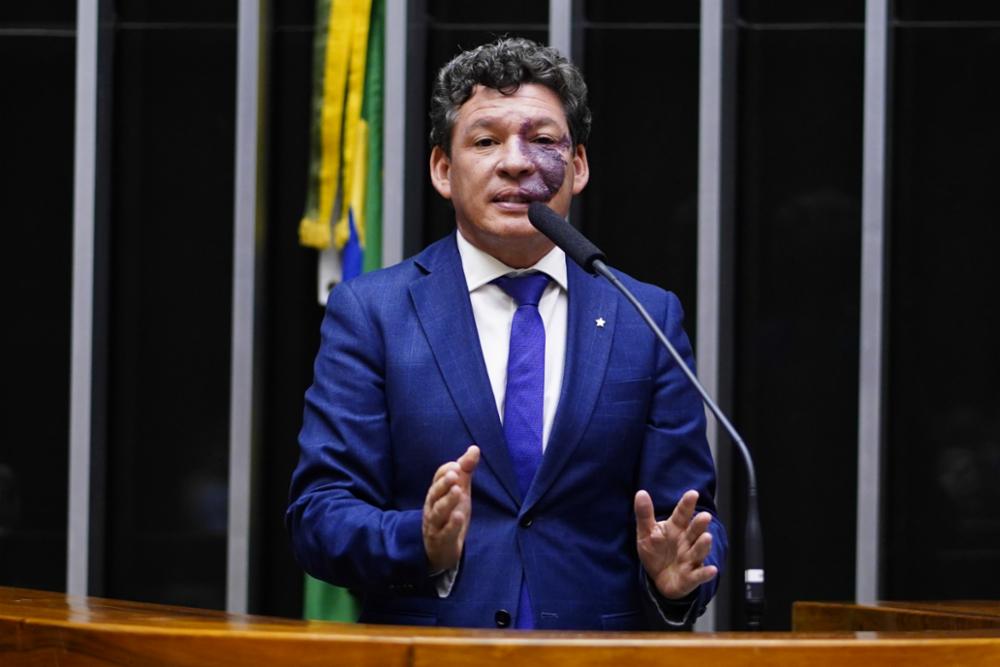 Relator da regulamentação da reforma tributária, Reginaldo Lopes busca diminuir a alíquota geral do IVA para ao menos 27,85%. Foto: Pablo Valadares/Câmara dos Deputados