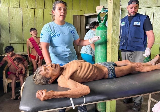 Tragédia brasileira: yanomami desnutrida recebe atendimento médico em cena chocante. Foto: redes sociais