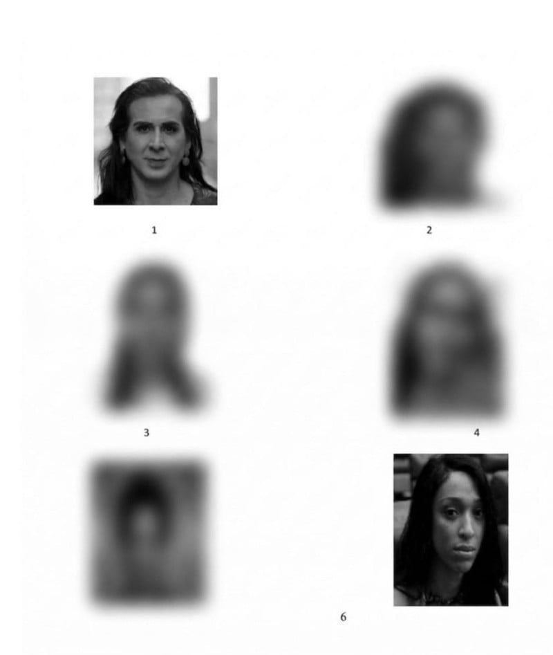 Segundo deputada, episódio foi doloso e retrata transfobia institucional.