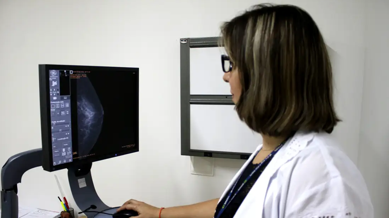 A proposta garante acesso anual gratuito ao exame a partir dos 40 anos.