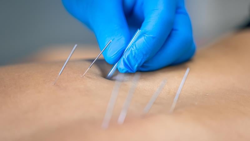 Projeto tramita na Casa desde 2019.